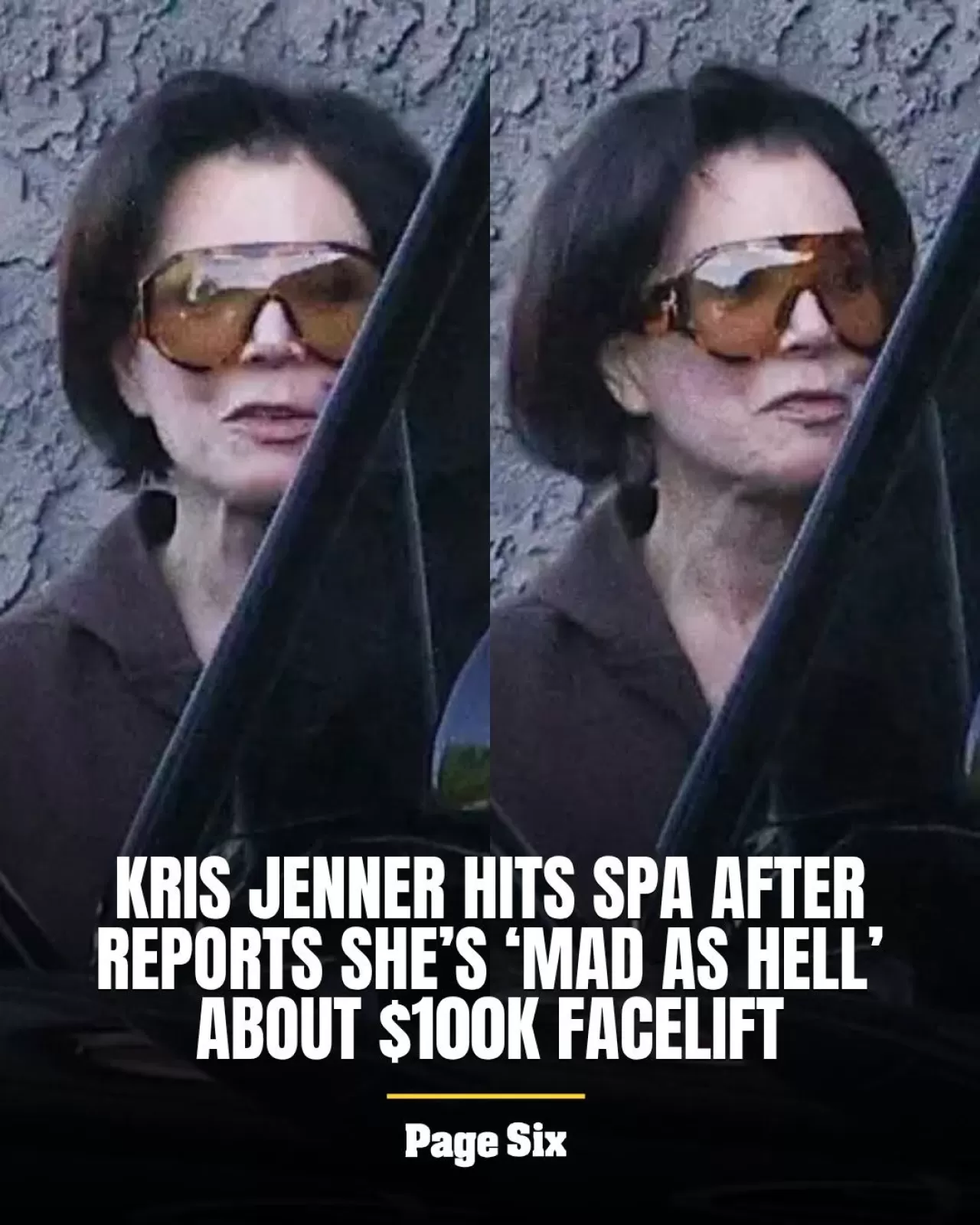 Kris Jenner, 100 Bin Dolarlık Yüz Germe Sonuçlarından Memnun Değil mi?